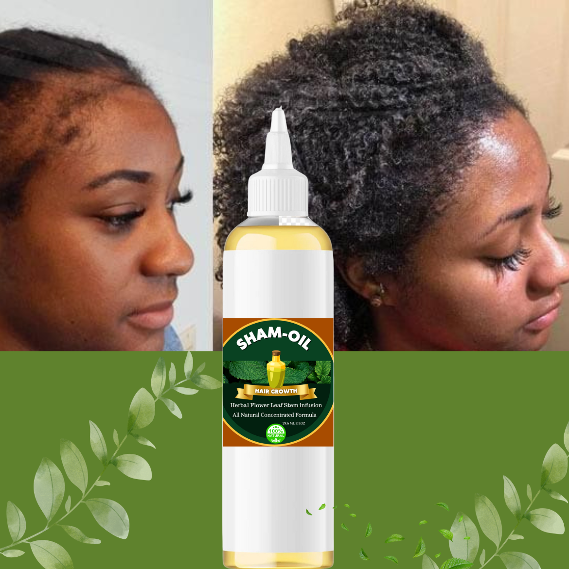 5.0z SHAM HAIR GROWTH OIL